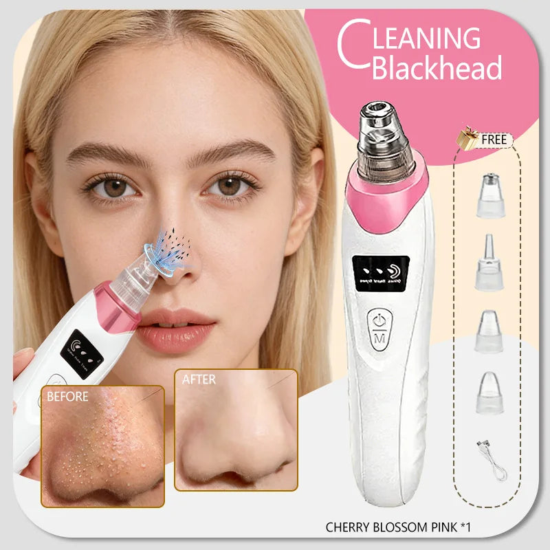 Effective Blackhead Remover Vacuum for Deep Facial Cleansing