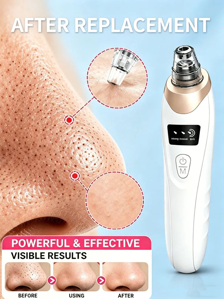Rechargeable Blackhead Vacuum - Pore Extractor for Clear Skin Care
