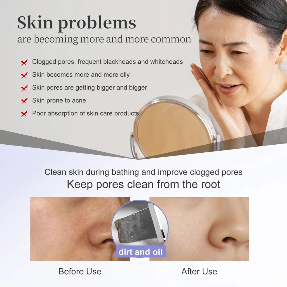 ANLAN Ultrasonic Facial Scrubber - Deep Cleansing & LED Therapy