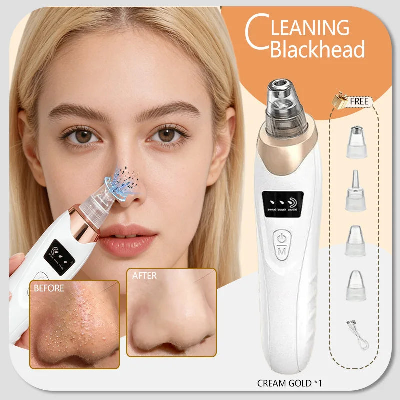 Rechargeable Blackhead Vacuum - Pore Extractor for Clear Skin Care