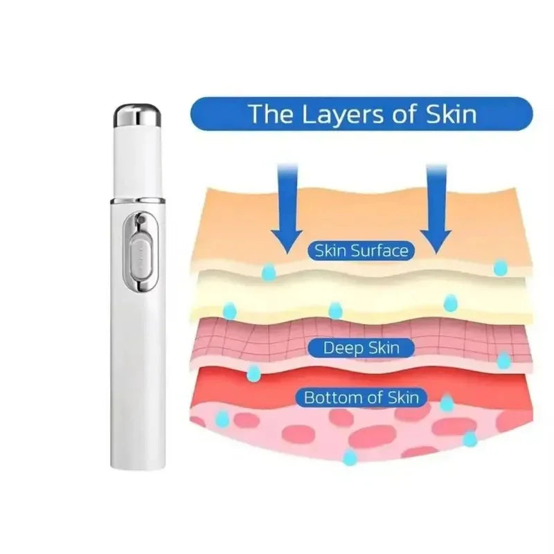 Fifth Gen Nail Laser Pen for Effective Onychomycosis Treatment