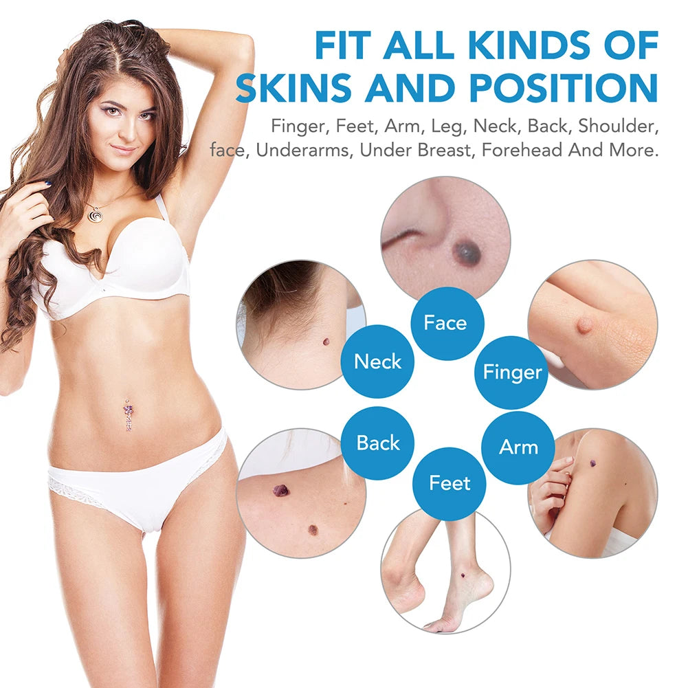 Effortless Skin Tag & Mole Removal Kit - Safe, Painless & Effective