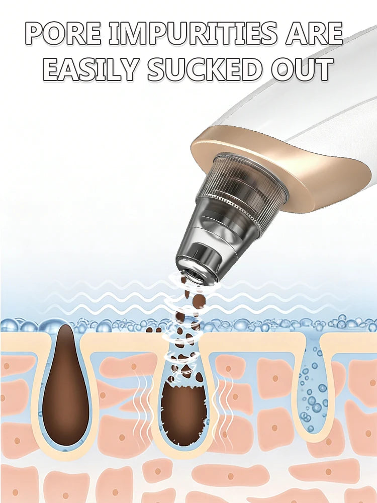 Rechargeable Blackhead Vacuum - Pore Extractor for Clear Skin Care