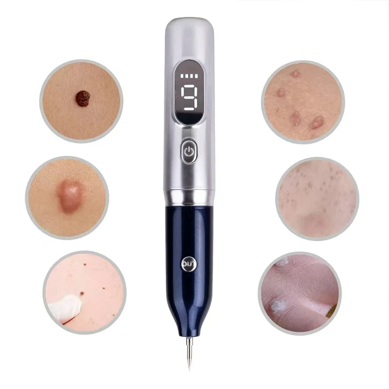 Laser Plasma Pen for Mole & Spot Removal - Safe & Effective Beauty Tool