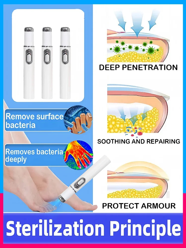 Fifth Gen Nail Laser Pen for Effective Onychomycosis Treatment