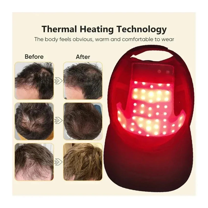LED Red Light Therapy Cap: Boost Hair Growth & Revitalize Hair
