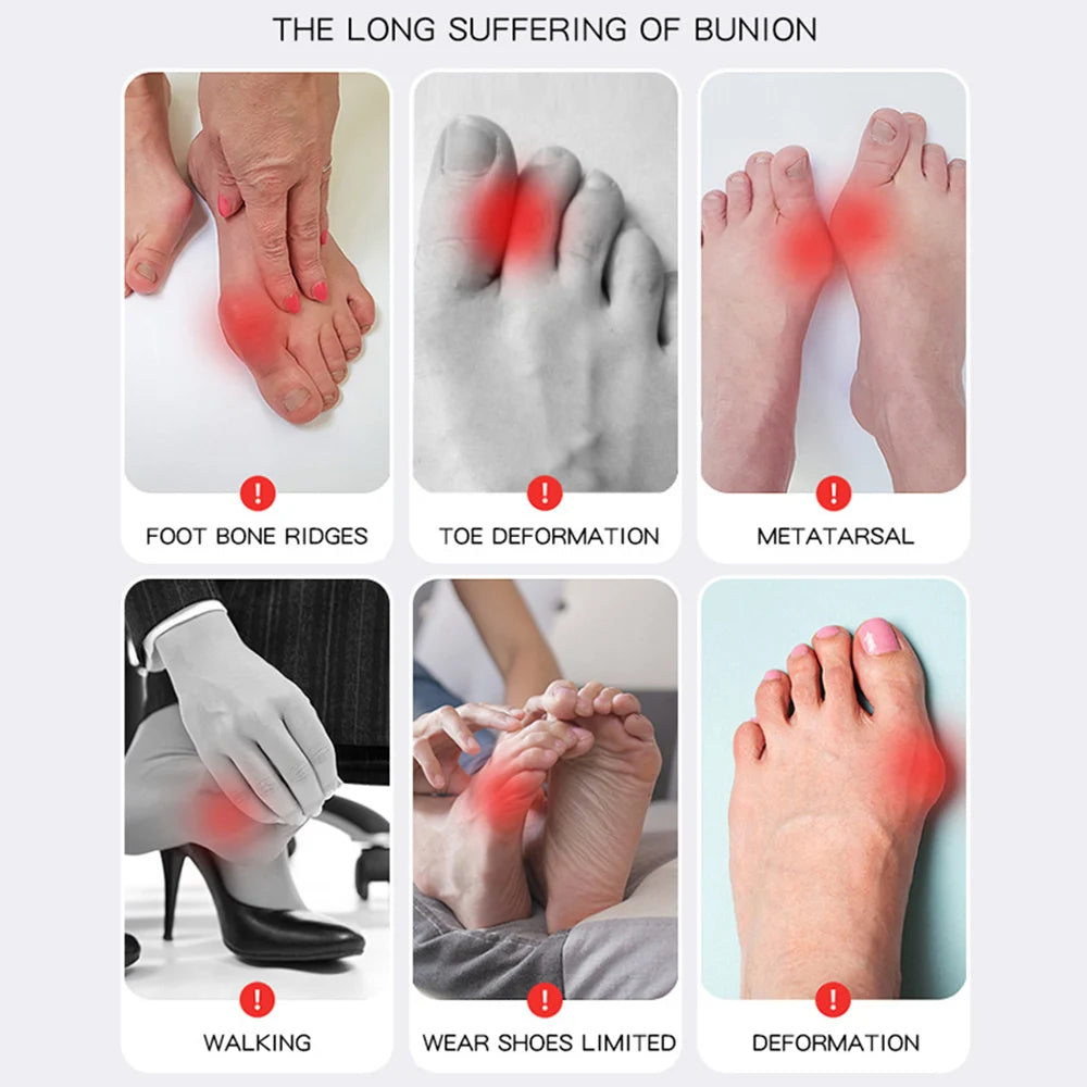 Adjustable Bunion Corrector Socks for Pain Relief & Toe Separation