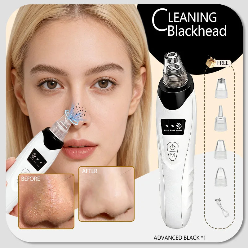 Effective Blackhead Remover Vacuum for Deep Facial Cleansing