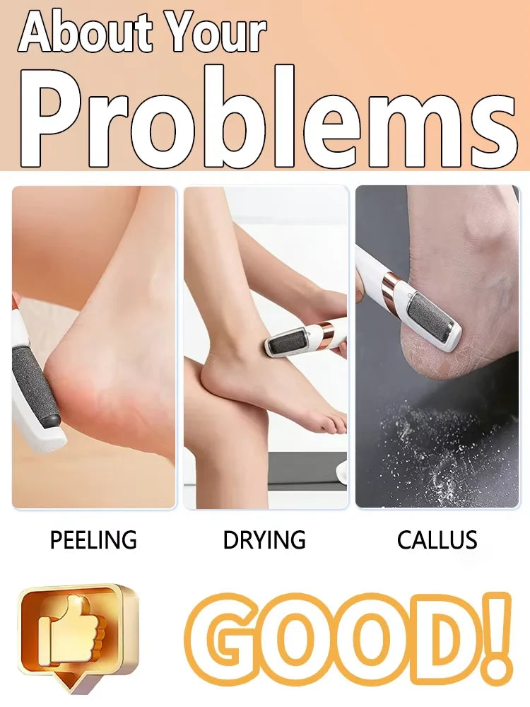 Portable Waterproof Callus Remover for Smooth & Healthy Feet