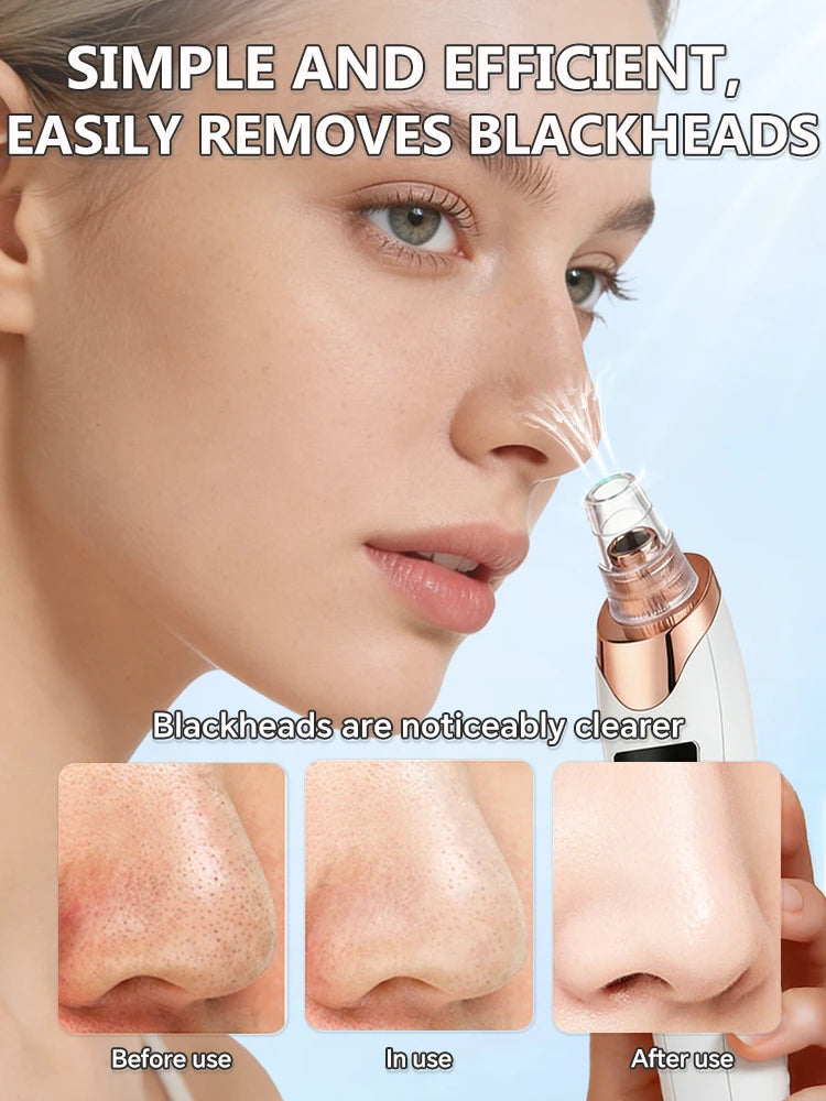 Rechargeable Blackhead Vacuum - Pore Extractor for Clear Skin Care