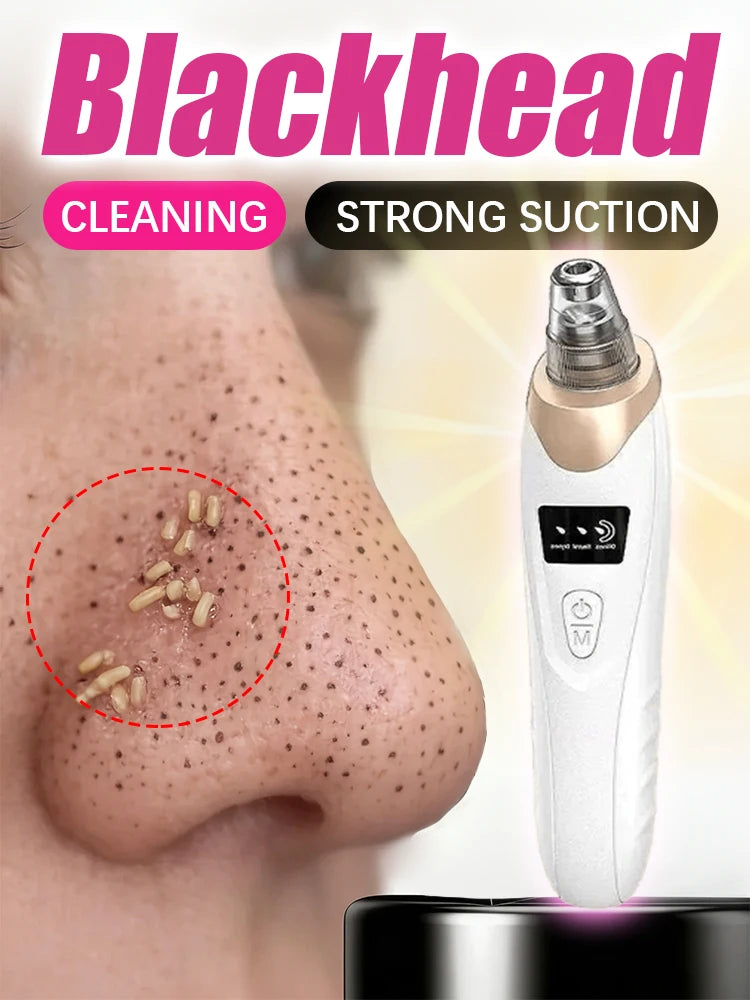 Effective Blackhead Remover Vacuum for Deep Facial Cleansing