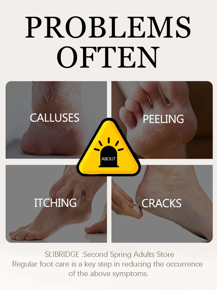 Foot Grinder & Callus Remover – Ultimate Foot Care Tool for Smooth Feet