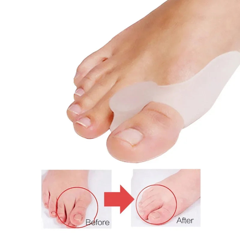2 Pcs Silicone Toes Separator for Foot Pain Relief & Comfort