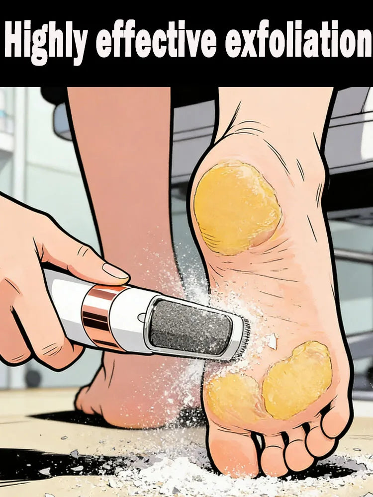 Electric Foot File - Ultimate Callus Remover & Foot Care Tool