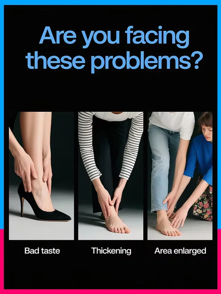 Fifth Gen Nail Laser Pen for Effective Onychomycosis Treatment