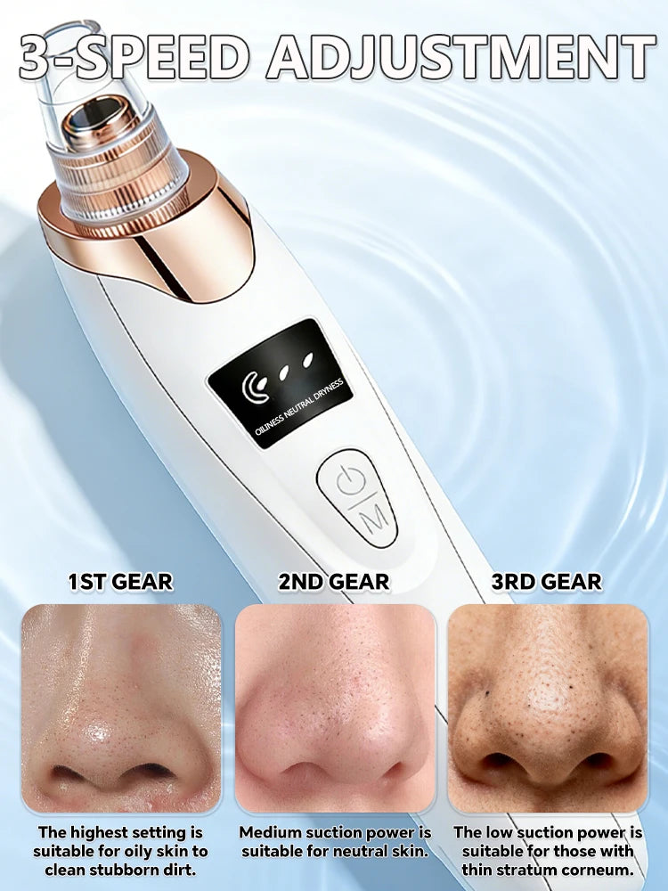 Effective Blackhead Remover Vacuum for Deep Facial Cleansing